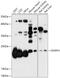 Deoxyribonucleoside 5 -monophosphate N-glycosidase antibody, 18-007, ProSci, Western Blot image 