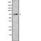 Calpain 6 antibody, abx148886, Abbexa, Western Blot image 