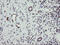 Replication Factor C Subunit 2 antibody, M07724, Boster Biological Technology, Immunohistochemistry paraffin image 