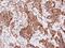 Actinin Alpha 2 antibody, NBP2-15355, Novus Biologicals, Immunohistochemistry paraffin image 