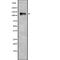 Period Circadian Regulator 3 antibody, abx147165, Abbexa, Western Blot image 