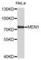 Menin 1 antibody, STJ112381, St John