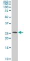 Synaptosome Associated Protein 23 antibody, H00008773-M01, Novus Biologicals, Western Blot image 