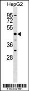 Solute carrier family 2, facilitated glucose transporter member 9 antibody, 58-771, ProSci, Western Blot image 