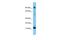 Fatty Acid Binding Protein 9 antibody, A16058, Boster Biological Technology, Western Blot image 