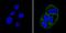 Insulin Receptor antibody, MA5-13756, Invitrogen Antibodies, Immunofluorescence image 