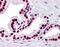 SMAD Family Member 6 antibody, 51-481, ProSci, Immunohistochemistry paraffin image 