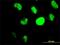 HIC ZBTB Transcriptional Repressor 1 antibody, H00003090-M01, Novus Biologicals, Immunofluorescence image 