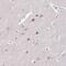 Actin Related Protein 3 antibody, PA5-61401, Invitrogen Antibodies, Immunohistochemistry frozen image 