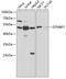 Dystrobrevin Binding Protein 1 antibody, A1632, ABclonal Technology, Western Blot image 