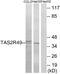 Taste 2 Receptor Member 20 antibody, A14508, Boster Biological Technology, Western Blot image 