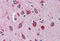 Serpin Family I Member 1 antibody, MBS246016, MyBioSource, Immunohistochemistry frozen image 