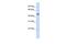 DDB1 And CUL4 Associated Factor 4 antibody, GTX45305, GeneTex, Western Blot image 