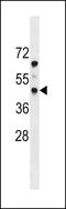 Platelet Derived Growth Factor Receptor Like antibody, 59-183, ProSci, Western Blot image 