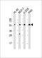 Eukaryotic Translation Initiation Factor 2B Subunit Gamma antibody, M08134, Boster Biological Technology, Western Blot image 