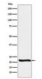 Glyoxalase I antibody, M01703, Boster Biological Technology, Western Blot image 