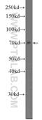 KBP antibody, 25653-1-AP, Proteintech Group, Western Blot image 