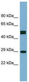 Homeobox C8 antibody, TA344561, Origene, Western Blot image 