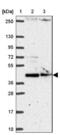 Damage Specific DNA Binding Protein 2 antibody, NBP2-38854, Novus Biologicals, Western Blot image 