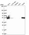 Serine Palmitoyltransferase Long Chain Base Subunit 1 antibody, HPA063907, Atlas Antibodies, Western Blot image 