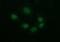 Tubulin Beta 2B Class IIb antibody, MA5-26267, Invitrogen Antibodies, Immunocytochemistry image 