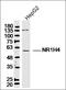 Nuclear Receptor Subfamily 1 Group H Member 4 antibody, orb156973, Biorbyt, Western Blot image 