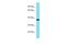 Dehydrogenase/Reductase 13 antibody, A15007, Boster Biological Technology, Western Blot image 