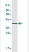 Netrin 1 antibody, H00009423-M01, Novus Biologicals, Western Blot image 