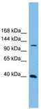 Mitogen-Activated Protein Kinase Kinase Kinase 14 antibody, TA346370, Origene, Western Blot image 
