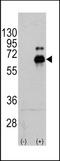 S6K antibody, TA302197, Origene, Western Blot image 
