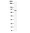 Heat Shock Protein Family A (Hsp70) Member 5 antibody, R31939, NSJ Bioreagents, Western Blot image 