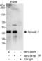 Sprouty RTK Signaling Antagonist 2 antibody, NBP2-04100, Novus Biologicals, Immunoprecipitation image 