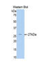 Alpha-2-Macroglobulin antibody, LS-C299050, Lifespan Biosciences, Western Blot image 