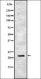 Cytochrome P450 Family 4 Subfamily F Member 8 antibody, orb337724, Biorbyt, Western Blot image 