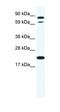 Zinc Finger Protein 287 antibody, orb324706, Biorbyt, Western Blot image 