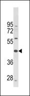 Protein Prenyltransferase Alpha Subunit Repeat Containing 1 antibody, LS-C162262, Lifespan Biosciences, Western Blot image 