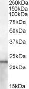 Lipocalin 2 antibody, MBS420046, MyBioSource, Western Blot image 