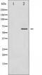 LIM Domain Kinase 2 antibody, TA325623, Origene, Western Blot image 