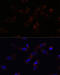 Sonic Hedgehog Signaling Molecule antibody, 23-134, ProSci, Immunofluorescence image 