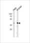 Activating Transcription Factor 2 antibody, 58-769, ProSci, Western Blot image 