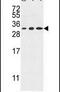 Tetraspanin 2 antibody, PA5-26329, Invitrogen Antibodies, Western Blot image 