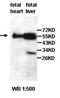 Zinc Finger CCHC-Type Containing 4 antibody, orb77706, Biorbyt, Western Blot image 