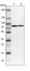 DEAD-Box Helicase 3 X-Linked antibody, NBP1-85290, Novus Biologicals, Western Blot image 