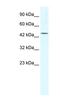 Eukaryotic Translation Initiation Factor 4A3 antibody, NBP1-57342, Novus Biologicals, Western Blot image 