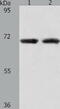 Acyl-CoA Thioesterase 11 antibody, TA322345, Origene, Western Blot image 