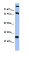 TBC1 Domain Family Member 7 antibody, orb326139, Biorbyt, Western Blot image 
