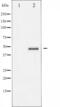 Aurora Kinase A antibody, abx011735, Abbexa, Western Blot image 