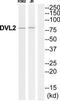 Dishevelled Segment Polarity Protein 2 antibody, TA313775, Origene, Western Blot image 