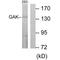 Cyclin G Associated Kinase antibody, A04246, Boster Biological Technology, Western Blot image 