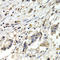 BUB1 Mitotic Checkpoint Serine/Threonine Kinase B antibody, LS-C331686, Lifespan Biosciences, Immunohistochemistry paraffin image 